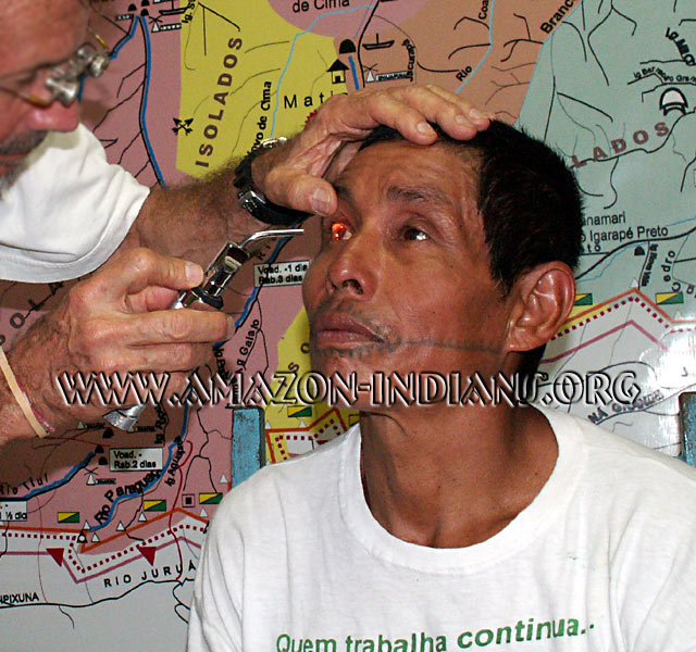 Mayoruna-Matses Eye Examination