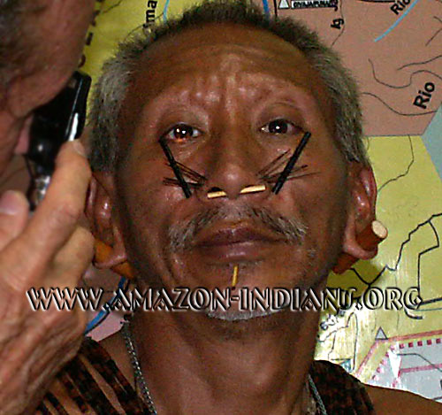 Matis Tribe Eye Examination